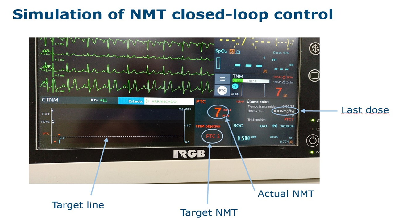 Simulation of NMT Infusion Control.bmp — VALU3S Repository